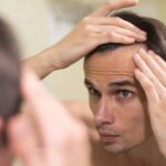 Effective Natural Remedies for Hair Loss in Men